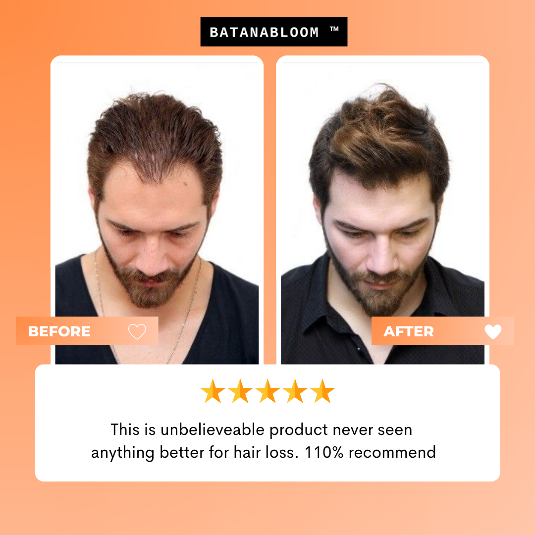 BATANABLOOM™ - Batana Hair Oil – For Strong, Healthy Hair