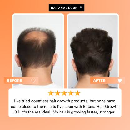 BATANABLOOM™ - Batana Hair Oil – For Strong, Healthy Hair