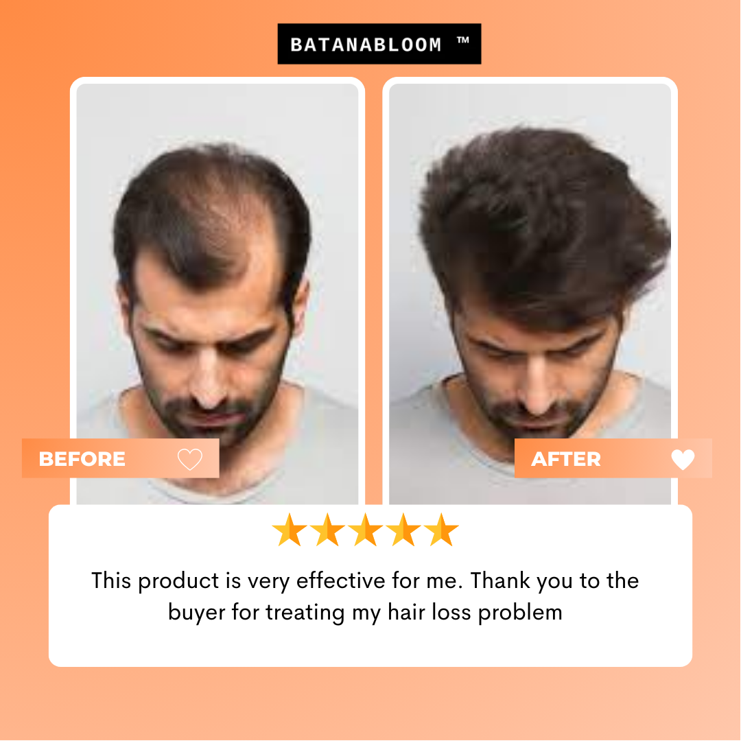 BATANABLOOM™ - Batana Hair Oil – For Strong, Healthy Hair