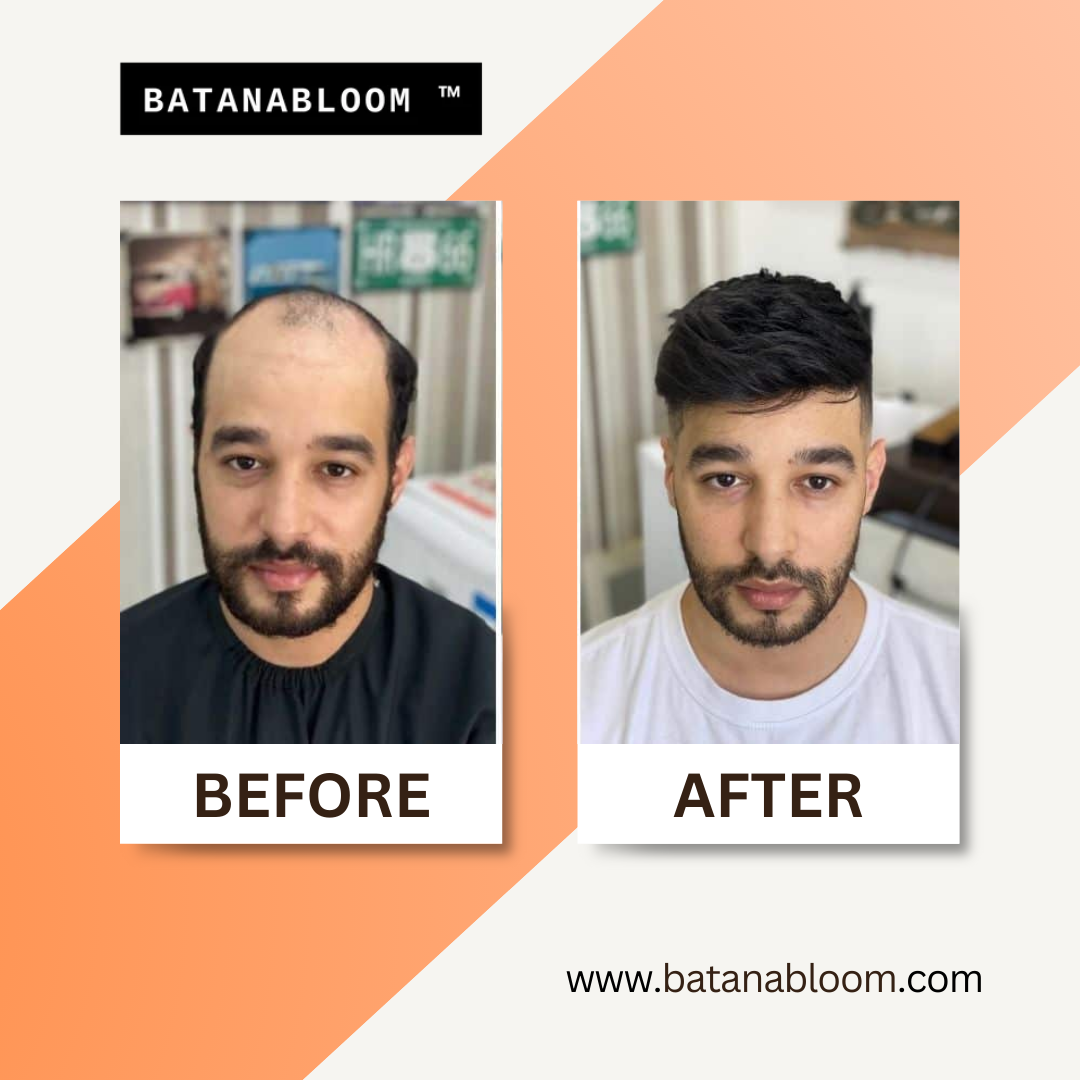 BATANABLOOM™ - Batana Hair Oil – For Strong, Healthy Hair