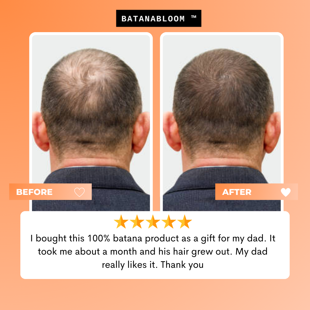 BATANABLOOM™ - Batana Hair Oil – For Strong, Healthy Hair