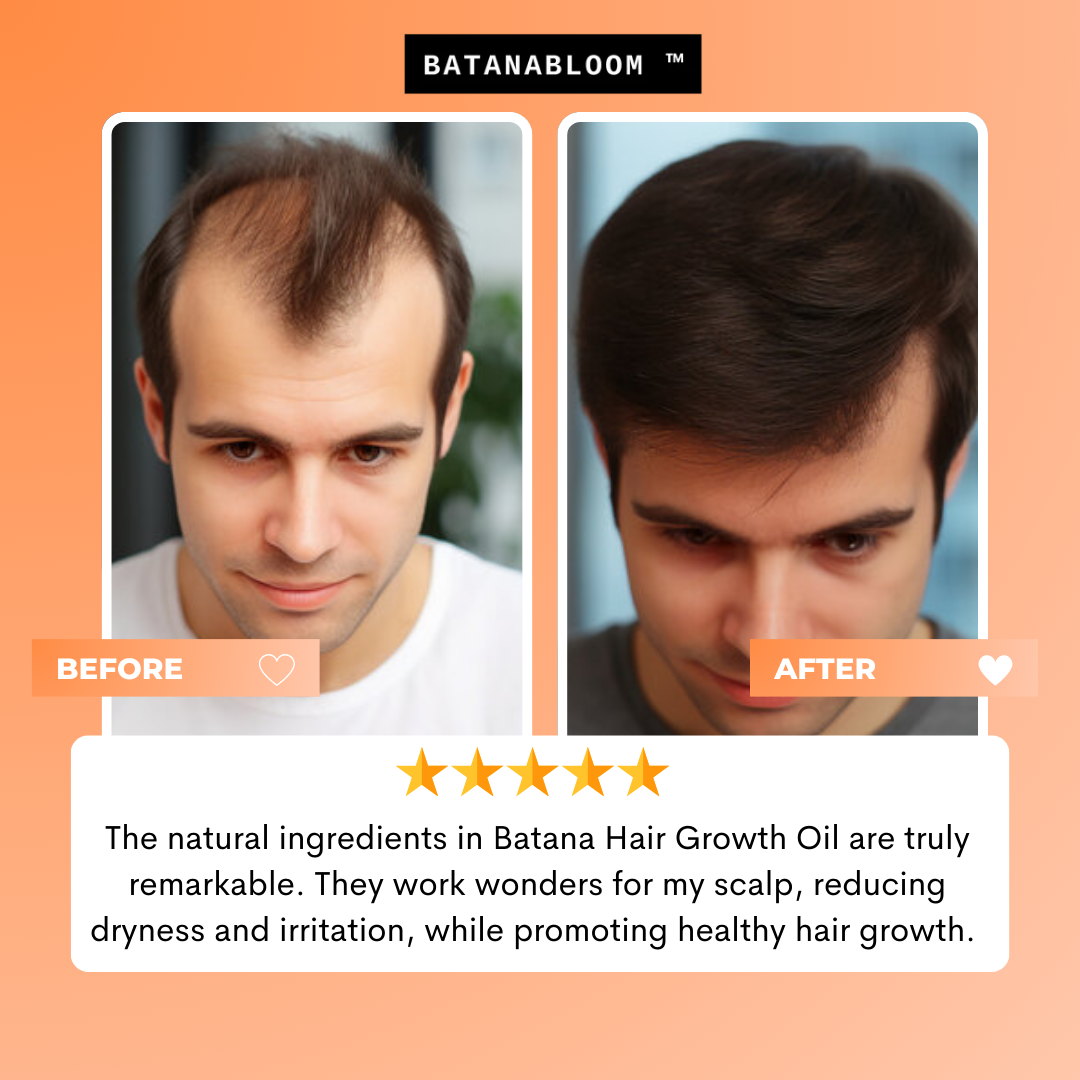 BATANABLOOM™ - Batana Hair Oil – For Strong, Healthy Hair