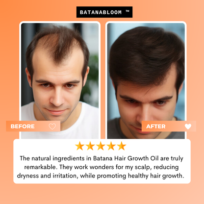 BATANABLOOM™ - Batana Hair Oil – For Strong, Healthy Hair