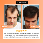 BATANABLOOM™ - Batana Hair Oil – For Strong, Healthy Hair - Thumbnail 8